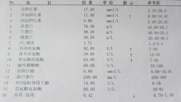 服务器主要指标（判断肝硬化的主要指标）-图3