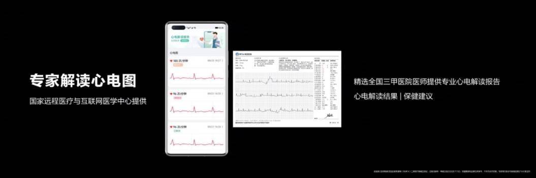 华为心电图（华为心电图怎么测）-图1